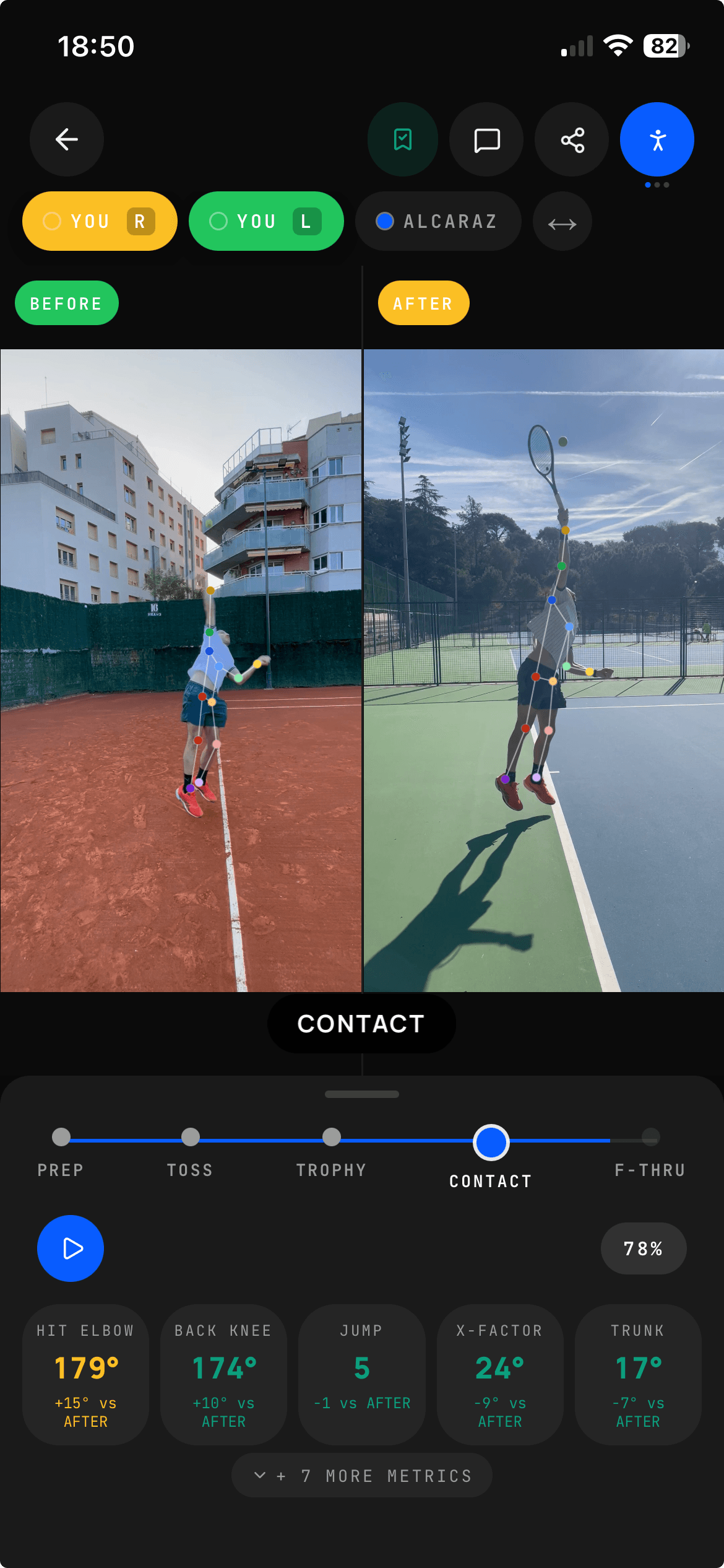 Before / After side-by-side compare of your own stroke at two points in time