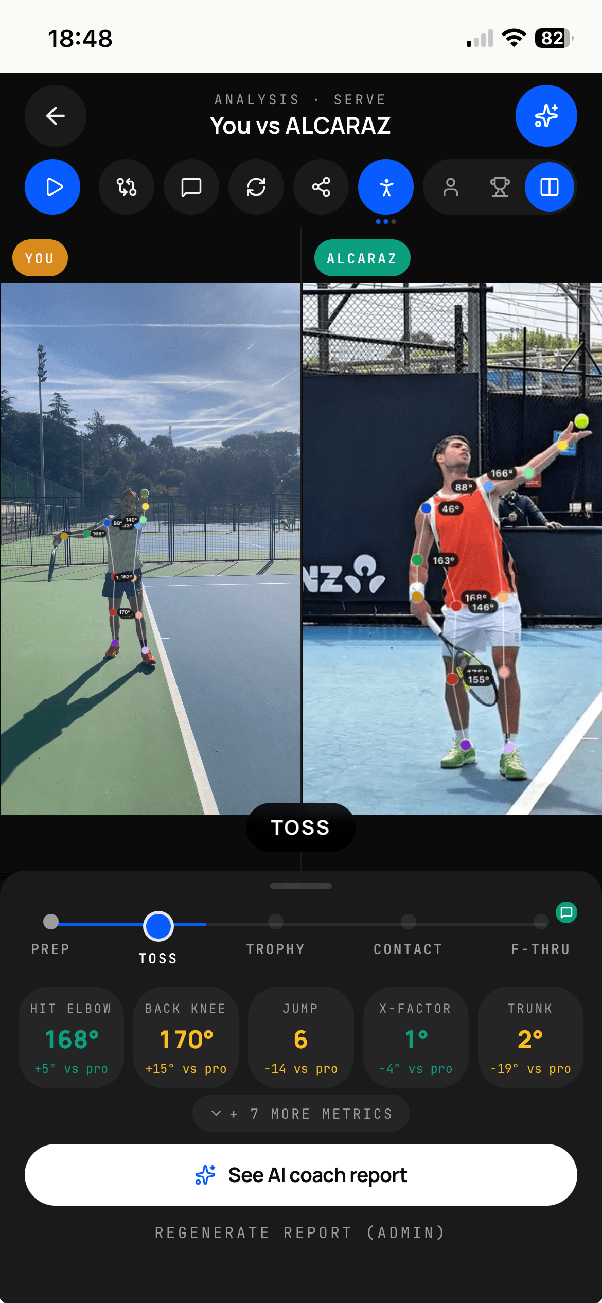 Side-by-side compare — your stroke vs a draib pro, synced phase by phase
